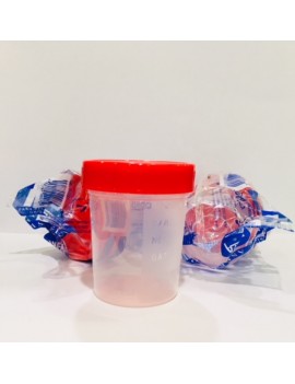 Frascos de Analisis de Orina Estériles